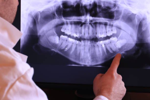 Best Dentist for Tooth Abscess  in Forty Fort, PA